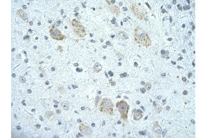 Rabbit Anti-FIP1L1 antibody        Paraffin Embedded Tissue:  Human Brain cell   Cellular Data:  Epithelial cells of renal tubule  Antibody Concentration:   4. (FIP1L1 Antikörper  (C-Term))