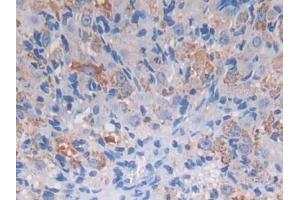 DAB staining on IHC-P; Samples: Mouse Ovary Tissue (PROZ Antikörper  (AA 23-399))