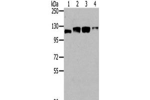 Western Blot analysis of Human fetal brain tissue, 231, 293T and Hela cells using UBA1 Polyclonal Antibody at dilution of 1/400