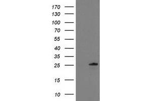 HEK293T cells were transfected with the pCMV6-ENTRY control (Left lane) or pCMV6-ENTRY C1orf50 (Right lane) cDNA for 48 hrs and lysed. (C1ORF50 Antikörper)