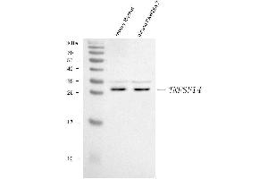 Western blot analysis of LIGHT/Tnfsf14 using anti-LIGHT/Tnfsf14 antibody (ABIN7599138).