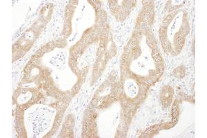 Immunohistochemistry (IHC) image for anti-Arrestin, beta 1 (ARRB1) (AA 368-418) antibody (ABIN7454956)