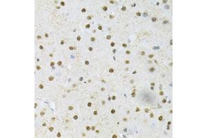 Immunohistochemistry of paraffin-embedded mouse brain using SNRPE Antibody (ABIN1876676) at dilution of 1:200 (40x lens). (SNRPE Antikörper)