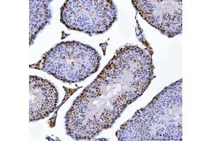 IHC analysis of MBNL1 using anti-MBNL1 antibody (ABIN7602608). (MBNL1 Antikörper  (AA 89-388))