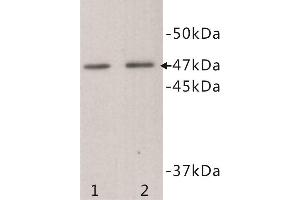 Western Blotting (WB) image for anti-Transmembrane Protein 200A (TMEM200A) antibody (ABIN1854992) (TMEM200A Antikörper)