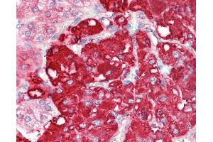 Anti-CMPK2 antibody IHC staining of human adrenal.