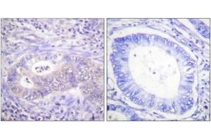 Immunohistochemistry (IHC) image for anti-6-phosphofructo-2-Kinase/fructose-2,6-Biphosphatase 2 (PFKFB2) (AA 451-500), (pSer483) antibody (ABIN1531479)