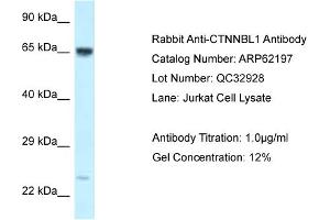 Western Blotting (WB) image for anti-Catenin, beta Like 1 (CTNNBL1) (C-Term) antibody (ABIN2789059) (CTNNBL1 Antikörper  (C-Term))