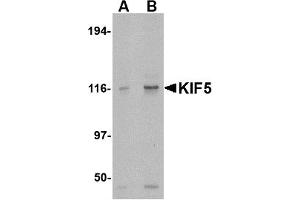Image no. 1 for anti-Kinesin Family Member 5A (KIF5A) (C-Term) antibody (ABIN203723) (KIF5A Antikörper  (C-Term))