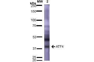 Western Blot analysis of Rat Brain showing detection of ~39 kDa (isoform 2) ATF4 protein using Mouse Anti-ATF4 Monoclonal Antibody, Clone S360A-24 . (ATF4 Antikörper  (AA 25-327) (APC))