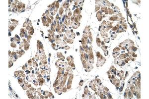 ITGB1BP2 antibody was used for immunohistochemistry at a concentration of 4-8 ug/ml to stain Skeletal muscle cells (arrows) in Human Muscle.