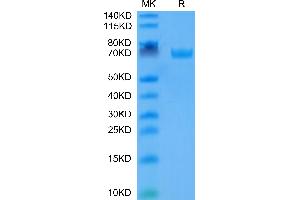 Human B7-H3 on Tris-Bis PAGE under reduced condition. (CD276 Protein (CD276) (AA 29-245) (Fc Tag))
