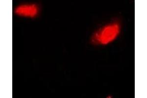 Immunofluorescent analysis of SIRT7 staining in Hela cells. (SIRT7 Antikörper)