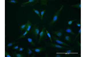 Immunofluorescence of purified MaxPab antibody to SETBP1 on HeLa cell.
