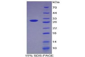 SDS-PAGE (SDS) image for CD274 (PD-L1) (AA 24-234) protein (His tag) (ABIN2126416) (PD-L1 Protein (AA 24-234) (His tag))
