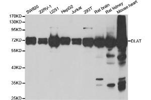 Western blot analysis of extracts of various cell lines, using DLAT antibody. (DLAT Antikörper)