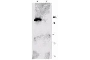 Western-blot analysis of p90 RSK1 immunoprecipitated from the mouse brain extract (B) and using RSK1-HRP as a probe. (RPS6KA1 Antikörper  (C-Term))
