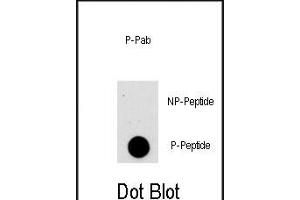 Dot blot analysis of anti-AKT1-p Phospho-specific Pab (Cat. (AKT1 Antikörper  (pSer473))