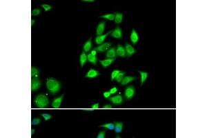 Immunofluorescence analysis of HeLa cells using NFS1 Polyclonal Antibody (NFS1 Antikörper)
