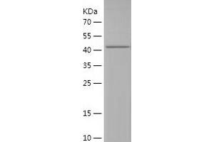 UBA5 Protein (AA 197-404) (His-IF2DI Tag)