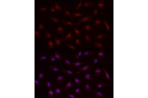 Immunofluorescence analysis of A-549 cells using Smad7 Rabbit pAb (ABIN6133913, ABIN6148093, ABIN6148095 and ABIN6215945) at dilution of 1:50 (40x lens). (SMAD7 Antikörper  (AA 1-100))