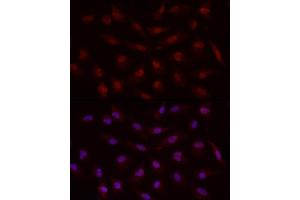 Immunofluorescence analysis of A-549 cells using Smad7 Rabbit pAb (ABIN6133913, ABIN6148093, ABIN6148095 and ABIN6215945) at dilution of 1:50 (40x lens). (SMAD7 Antikörper  (AA 1-100))