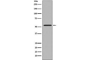 Western blot analysis of Smad2 expression in Jurkat cell lysate. (Rekombinanter SMAD2 Antikörper)