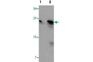 Western blot analysis of MCF-7 cells with BCAS2 polyclonal antibody  at (Lane 1) 0. (BCAS2 Antikörper  (C-Term))