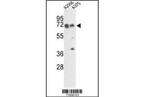 Western blot analysis of FKBP10 Antibody in A2058 and A375 cell line lysates (35ug/lane)