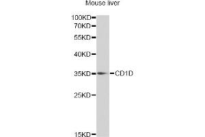 Western blot analysis of extracts of mouse liver, using CD1D antibody (ABIN6292676) at 1:1000 dilution. (CD1d Antikörper)