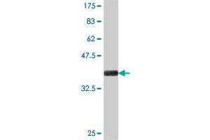 Western Blot detection against Immunogen (37. (ILKAP Antikörper  (AA 293-392))