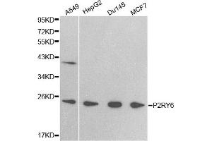 Western blot analysis of extracts of various cell lines, using P2RY6 antibody (ABIN5971321) at 1/500 dilution. (P2RY6 Antikörper)