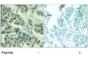 Image no. 3 for anti-Mdm2, p53 E3 Ubiquitin Protein Ligase Homolog (Mouse) (MDM2) (Ser166) antibody (ABIN319418) (MDM2 Antikörper  (Ser166))