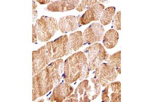 Immunohistochemical analysis of paraffin-embedded H. (COX6A2 Antikörper  (AA 37-66))