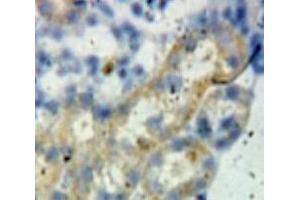 Used in DAB staining on fromalin fixed paraffin-embedded Kidney tissue (BCL2L1 Antikörper  (AA 2-212))