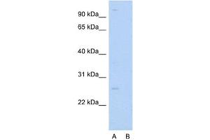 Western Blotting (WB) image for anti-RAB14, Member RAS Oncogene Family (RAB14) (C-Term) antibody (ABIN2792300)