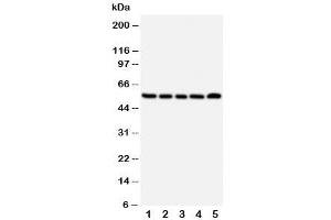 Western blot testing of NK1R antibody and Lane 1:  A549 (TACR1 Antikörper  (Middle Region))
