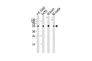 Western blot analysis of lysates from HT-1080, T47D cell line, mouse brain and testis tissue lysate (from left to right), using TUBA1C Antibody at 1:1000 at each lane. (TUBA1C Antikörper  (N-Term))
