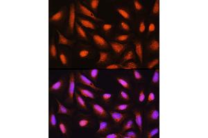 Immunofluorescence analysis of U-2 OS cells using GMFB Rabbit pAb (ABIN6131732, ABIN6141181, ABIN6141182 and ABIN6224741) at dilution of 1:100 (40x lens). (GMFB Antikörper  (AA 1-140))
