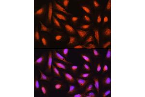 Immunofluorescence analysis of U-2 OS cells using GMFB Rabbit pAb (ABIN6131732, ABIN6141181, ABIN6141182 and ABIN6224741) at dilution of 1:100 (40x lens). (GMFB Antikörper  (AA 1-140))
