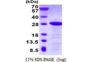 Image no. 1 for Dysbindin (Dystrobrevin Binding Protein 1) Domain Containing 2 (DBNDD2) (AA 1-161) protein (His tag) (ABIN1098650)