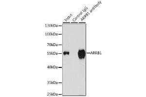 Immunoprecipitation (IP) image for anti-Arrestin, beta 1 (ARRB1) (AA 169-418) antibody (ABIN3021265)