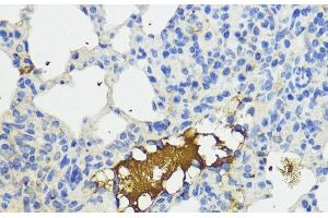 Immunohistochemistry of paraffin-embedded Mouse lung using Complement Factor B Polyclonal Antibody at dilution of 1:200 (40x lens). (Complement Factor B Antikörper)