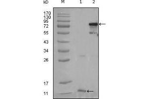 Western Blot showing PPARG antibody used against truncated PPARG-His recombinant protein (1) and full-length PPARG (aa1-477) transfected CHO-K1 cell lysate (2). (PPARG Antikörper  (AA 170-270))