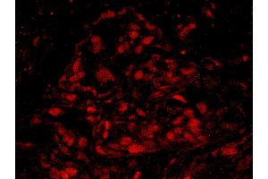Immunofluorescence (IF) image for anti-Breast Cancer 1 (BRCA1) (AA 700-750) antibody (ABIN7448934) (BRCA1 Antikörper  (AA 700-750))