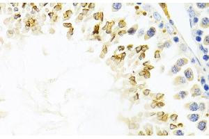 Immunohistochemistry of paraffin-embedded Mouse testis using GEMIN2 Polyclonal Antibody at dilution of 1:100 (40x lens). (SIP1 Antikörper)