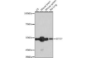 Western blot analysis of extracts of various cell lines, using SETD7 Rabbit mAb (ABIN7270261) at 1:1000 dilution.