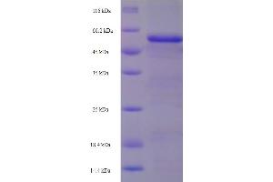 SDS-PAGE (SDS) image for serpin Peptidase Inhibitor, Clade E (Nexin, Plasminogen Activator Inhibitor Type 1), Member 2 (SERPINE2) (AA 20-398) protein (His-SUMO Tag) (ABIN5710346)