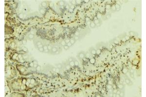 ABIN6277100 at 1/100 staining Mouse colon tissue by IHC-P. (SMARCA4 Antikörper  (N-Term))