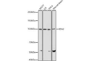 Western blot analysis of extracts of various cell lines, using EZH2 antibody (ABIN6133511, ABIN6140395, ABIN6140399 and ABIN6221414) at 1:1000 dilution. (EZH2 Antikörper  (AA 1-250))